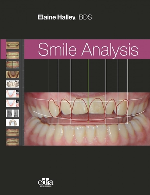 Smile Analysis - Halley, Elaine