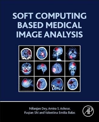 Soft Computing Based Medical Image Analysis - Dey, Nilanjan, PhD, and Ashour, Amira S., and Shi, Fuquian