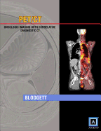Specialty Imaging: PET/CT: Oncologic Imaging with Correlative Diagnostic CT (Published by Amirsys)