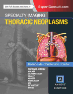 Specialty Imaging: Thoracic Neoplasms