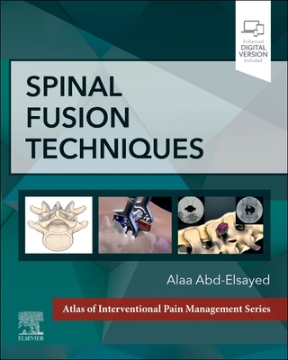 Spinal Fusion Techniques - Abd-Elsayed, Alaa, MD, MPH