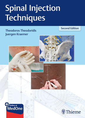 Spinal Injection Techniques - Theodoridis, Theodoros (Editor), and Kr�mer, J�rgen (Editor)