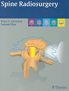 Spine Radiosurgery