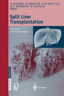 Split Liver Transplantation: Theoretical and Practical Aspects - Rogiers, X (Editor), and Bismuth, H (Editor), and Busuttil, R W (Editor)