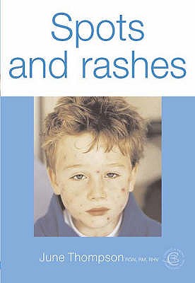 Spots and Rashes - Thompson, June