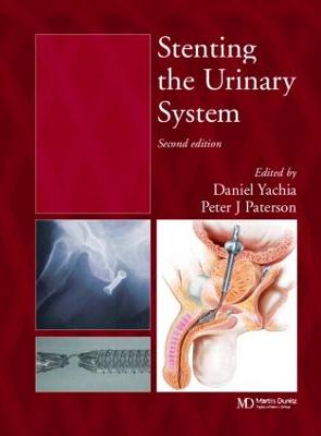 Stenting the Urinary System - Yachia, Daniel, and Paterson, Peter J