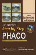 Step by Step Phacoemulsification