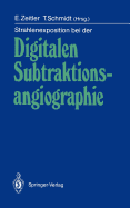 Strahlenexposition Bei Der Digitalen Subtraktionsangiographie