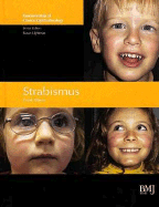 Strasbismus