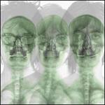 Supergrass