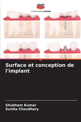Surface et conception de l'implant - Kumar, Shubham, and Choudhary, Sunita