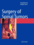 Surgery of Spinal Tumors
