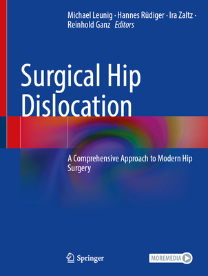 Surgical Hip Dislocation: A Comprehensive Approach to Modern Hip Surgery - Leunig, Michael (Editor), and R�diger, Hannes A (Editor), and Zaltz, Ira (Editor)