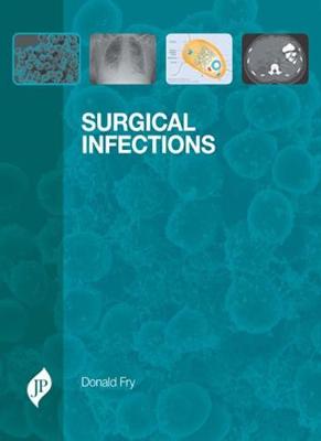 Surgical Infections - Fry, Donald