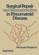 Surgical Repair and Reconstruction in Rheumatoid Disease