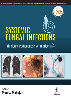 Systemic Fungal Infections: Principles, Pathogenesis & Practice - Mahajan, Monica