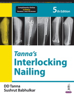 Tanna's Interlocking Nailing