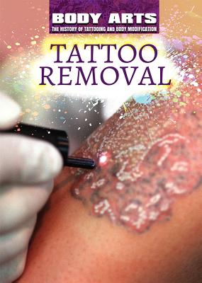 Tattoo Removal - Faulkner, Nicholas, and Spalding, Frank
