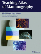 Teaching Atlas of Mammography