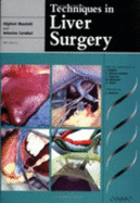 Techniques in Liver Surgery - Mazziotti, Alighieri (Editor), and Cavallari, Antonino (Editor), and Belghiti, J (Contributions by)