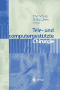 Tele- Und Computergestutzte Chirurgie