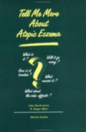 Tell Me More about Atopic Eczema: A Patient's Guide