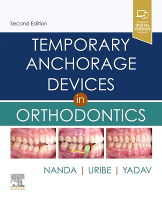 Temporary Anchorage Devices in Orthodontics - Nanda, Ravindra (Editor), and Uribe, Flavio Andres, Dds (Editor), and Yadav, Sumit, PhD (Editor)