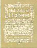 Textbook of Diabetes, Second Edition