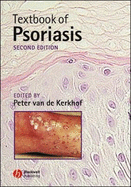 Textbook of Psoriasis