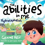 The abilities in me: Hydrocephalus