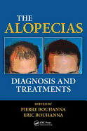The Alopecias: Diagnosis and Treatments
