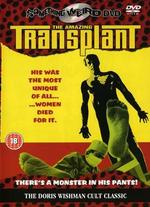 The Amazing Transplant