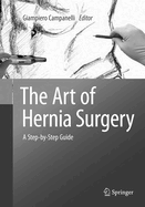 The Art of Hernia Surgery: A Step-By-Step Guide