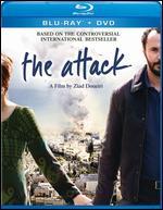 The Attack