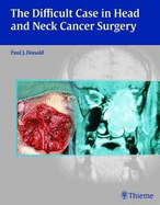 The Difficult Case in Head and Neck Cancer Surgery