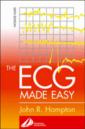 The ECG Made Easy