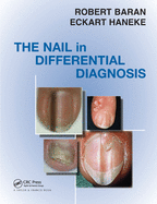 The Nail in Differential Diagnosis