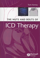 The Nuts and Bolts of ICD Therapy
