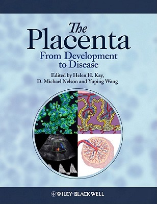 The Placenta: From Development to Disease - Kay, H