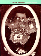 The Poet Assassinated