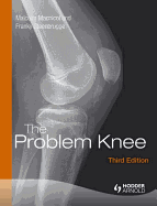 The Problem Knee