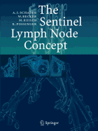 The Sentinel Lymph Node Concept