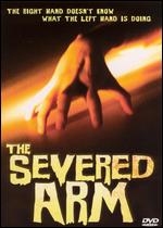 The Severed Arm - Thomas S. Alderman