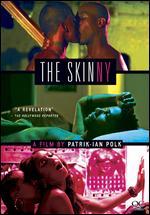 The Skinny