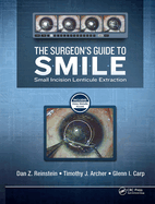 The Surgeon's Guide to Smile: Small Incision Lenticule Extraction