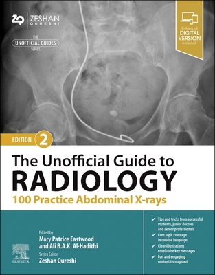 The Unofficial Guide to Radiology: 100 Practice Abdominal X-rays - Eastwood, Patrice (Editor), and Al-Hadithi, Ali B.A.K. (Editor), and Qureshi, Zeshan, BM, MSc (Editor)