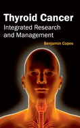 Thyroid Cancer: Integrated Research and Management
