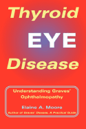 Thyroid Eye Disease: Understanding Graves' Ophthalmopathy