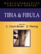 TIBIA & FIBIA - Court-Brown, Charles M