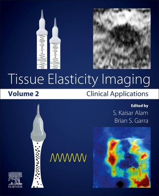 Tissue Elasticity Imaging: Volume 2: Clinical Applications - Alam, Kaisar S. (Editor), and Garra, Brian S. (Editor)